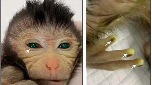  Científicos crean un mono híbrido para profundizar en la comprensión de enfermedades humanas