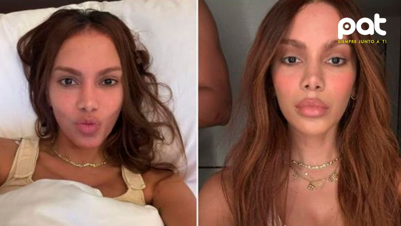 http://www.redpat.tv//uploads/Anitta_causa_polemica_por_su_nuevo_rostro_0c7212a9fa.jpg