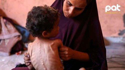 Gaza al borde del colapso: más de 100 organizaciones denuncian hambruna generalizada
