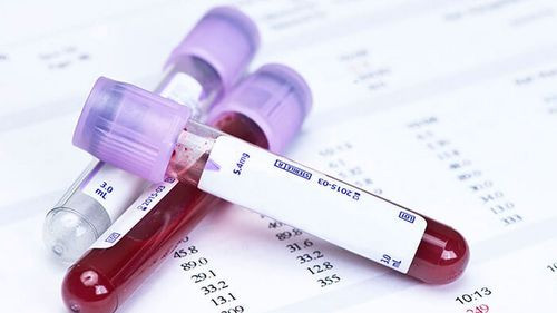 El prometedor examen de sangre para detectar más de 50 tipos de cáncer 