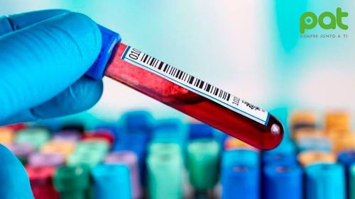 Nuevo análisis de sangre para diagnosticar y rastrear la enfermedad de Alzheimer