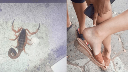Joven picada por alacrán relata su experiencia y la falta de información en centros de salud