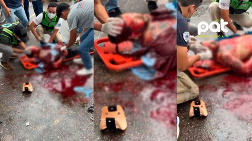 Choque fatal en el Mercado Mutualista: Motociclista gravemente herido tras impacto con camioneta