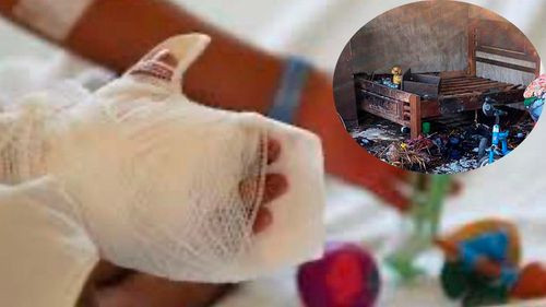 Padre del niño quemado clama por justicia mientras su hijo lucha por su vida