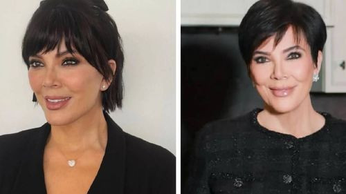 Kris Jenner muestra su rostro tras un lifting de 100 mil dólares y genera debate en redes sociales Kris Jenner muestra su rostro tras un lifting de 100 mil dólares y genera debate en redes sociales