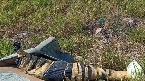 Confirman que ciudadano colombiano abandonado en Yapacaní falleció de un disparo