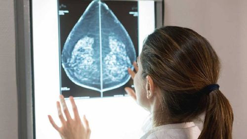 Estudio no ve grandes cambios en combinación de fármacos para cáncer de mama avanzado