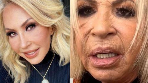 Laura Bozzo se pondrá jovencita se someterá a una cirugía plástica para REJUVENECER su rostro