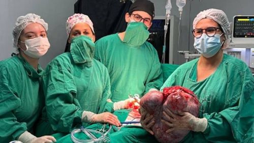  Extirpan un quiste de ovario de más de 12 kilos a una joven en un hospital de Paraguay