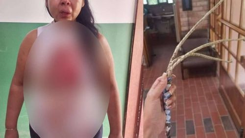Mujer torturada y secuestrada por celos de su patrona 