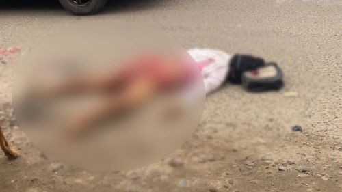  Trágico accidente en Yapacaní: Joven pierde la vida en choque entre volqueta y moto