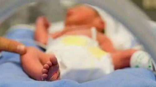 Nace bebé con cola de 10 centímetros en China: Médicos advierten riesgos en su extirpación