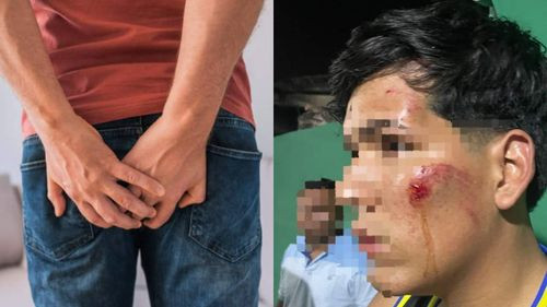 Denuncia por Flatulencia: Agresión Brutal Después de un Incidente inusual en Montero