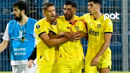 Violencia empaña partido de Copa Libertadores: Futbolista agredido en el Gigante de Arroyito