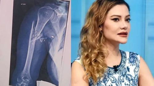 Abogado de Nadia Beller revela la gravedad de sus lesiones