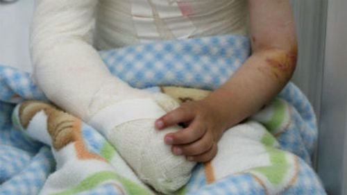 Niño en terapia intensiva tras incendio provocado por su padre luego de haber matado a la madre en Santa Cruz