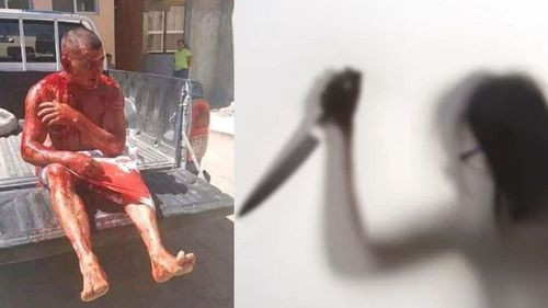 Imagen de Honduras: mujer habría castrado a su esposo tras encontrarlo con otra mujer