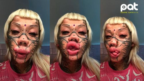 Más de 30 modificaciones para convertirse en “gata zombi”: así vive la joven que decidió eliminar su nariz y ombligo