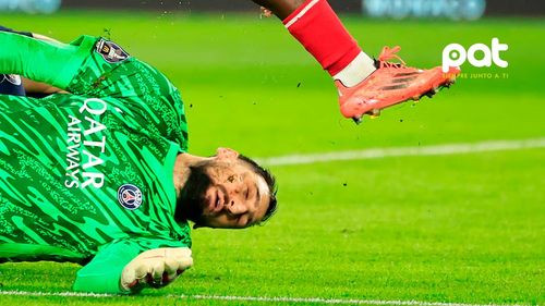 Las impactantes imágenes de cómo quedó el rostro de Gianluigi tras recibir la brutal patada 