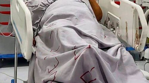 Imagen de Conmoción en Pando: Madre apuñalada nueve veces por su hijo corrió por toda la casa para salvar su vida
