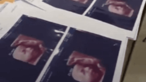 Clínica acusada de utilizar la  misma foto de ecografías 5D en varios embarazos diferentes