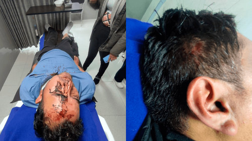 Grupos violentos atacan a senadores Varela y Flores en Vila Vila: heridos y daños materiales