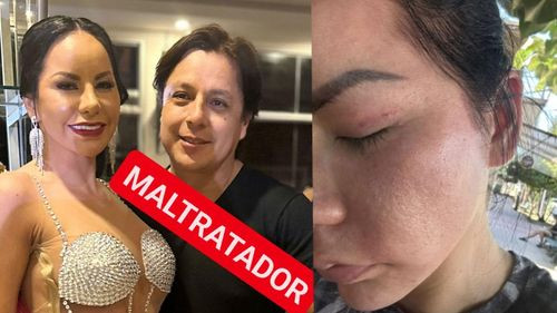 Mayte Flores denuncia agresiones físicas y psicológicas por parte de su pareja