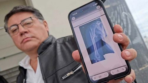 Abogado de Beller afirma que supuestos chats vinculan a Cerimedo con el atentado