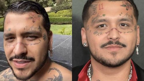 La transformación de Nodal tras removerse los tatuajes faciales
