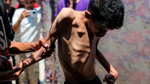 Hambruna en Gaza es la más planeada desde la Segunda Guerra Mundial          