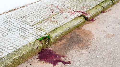 Intentó robar un domicilio, se hirió con un fierro y murió
