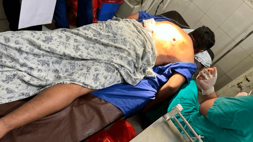 Turba ataca a efectivos antidroga y deja un sargento herido de bala