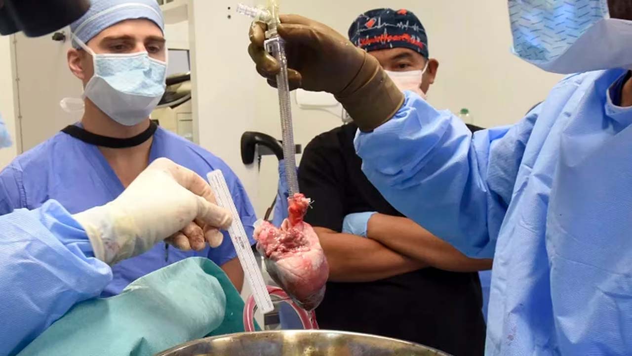 Transplante de ógano de animal.jpg
